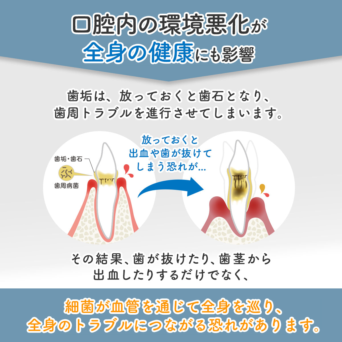 口腔内の環境悪化は全身の健康にも影響